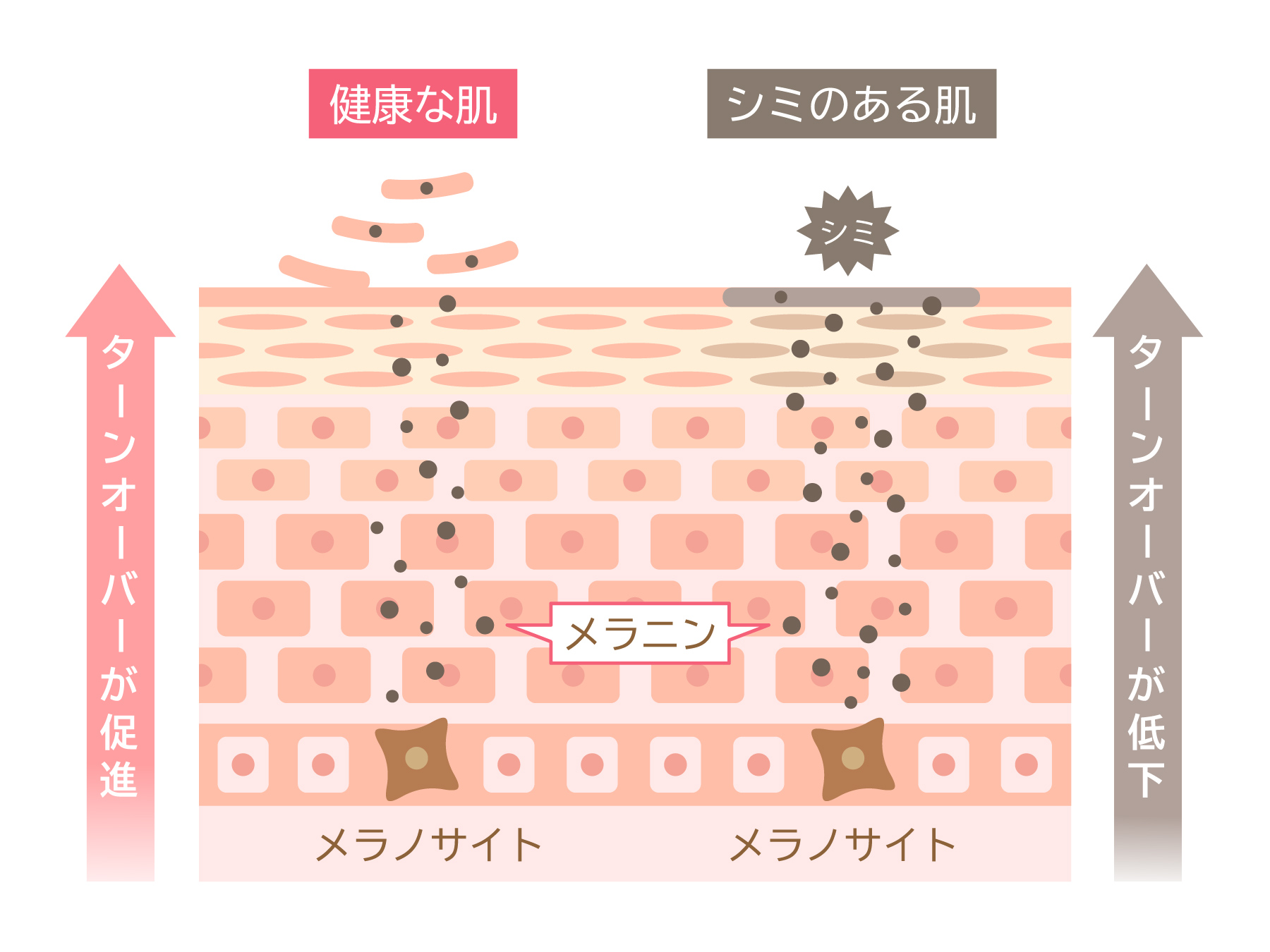 turnoveroftheskin